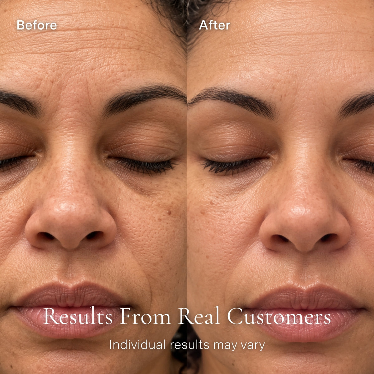 Restorative Complex Face Serum with Salmon PDRN