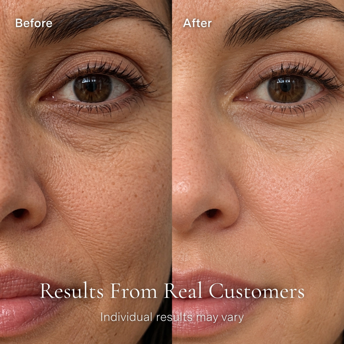 Restorative Complex Face Serum with Salmon PDRN